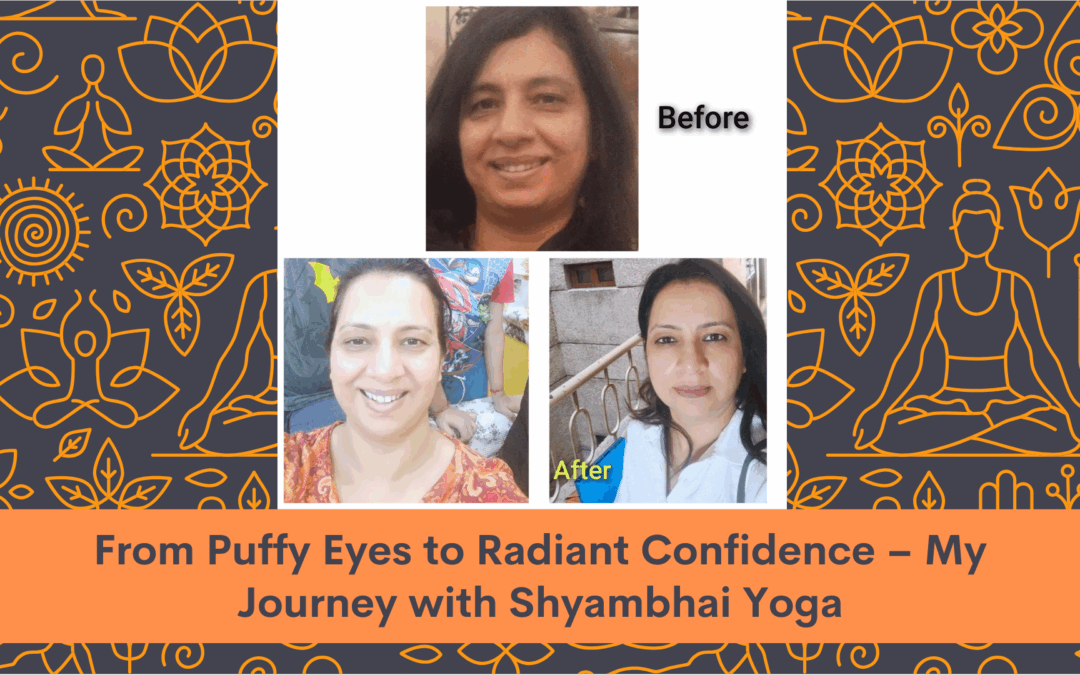 From Puffy Eyes to Radiant Confidence – My Journey with Shyambhai Yoga