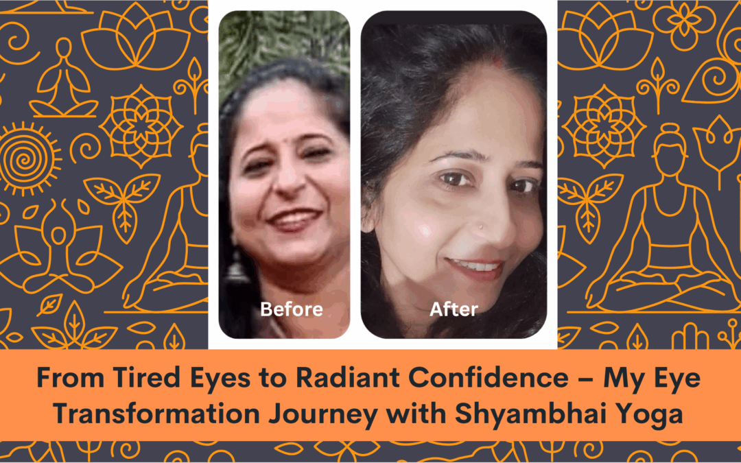 From Tired Eyes to Radiant Confidence – My Eye Transformation Journey with Shyambhai Yoga