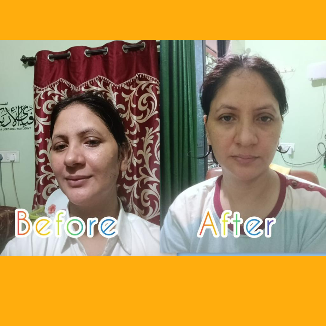 Face yoga (7)