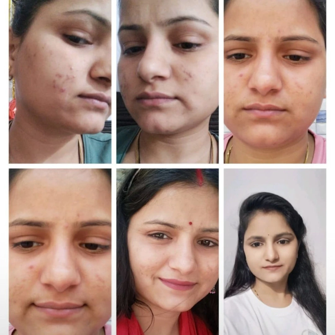 Face Yoga Reviews
